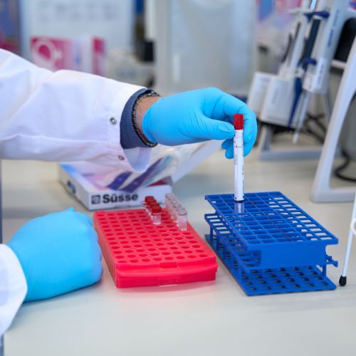 Zelftesten voor chlamydia: Hoe betrouwbaar zijn ze in 2025?