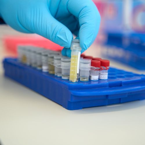 Nieuwe antibioticaresistentie bij gonorroe