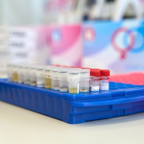 Van mainstage naar thuistest