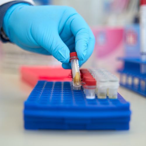 Mycoplasma versus chlamydia: wat zijn de verschillen?